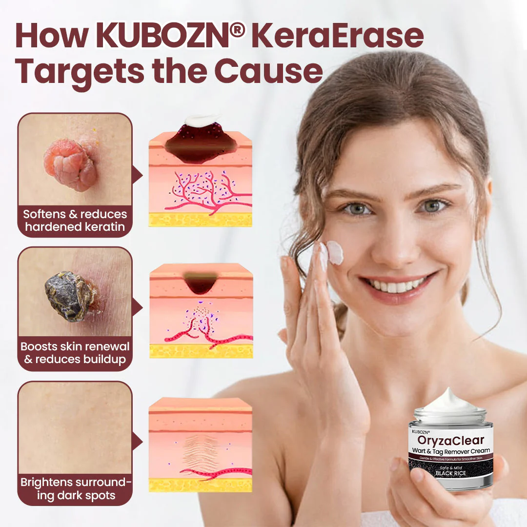⭐KUBOZN® OryzaClear – Black Rice Softening Cream · Botanical Care for Skin Tags & Uneven Texture - Image 2