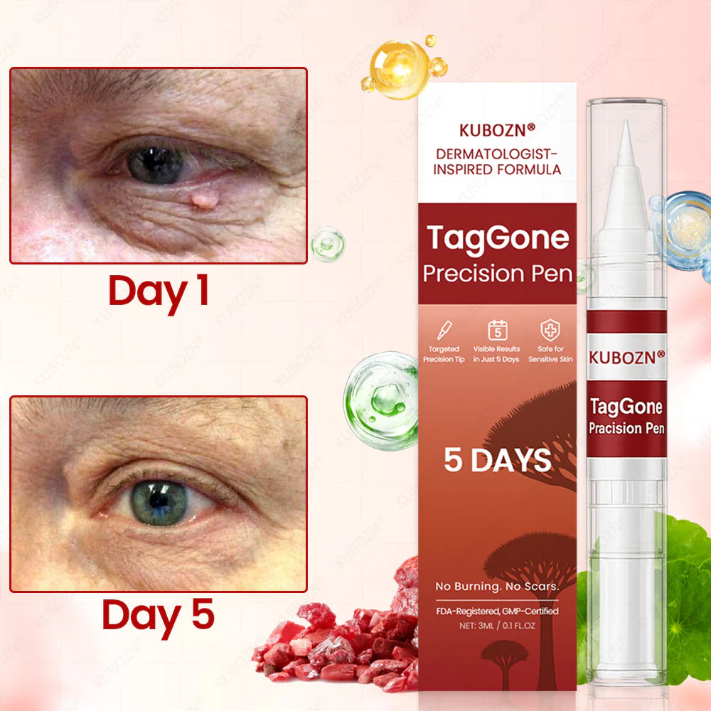 ✨KUBOZN® TagGone Precision Pen (2025 Upgrade) | Skin Tag, Mole & Wart Remover – Fast, Gentle & Scar-Free in 5 Days (offer) - Image 2