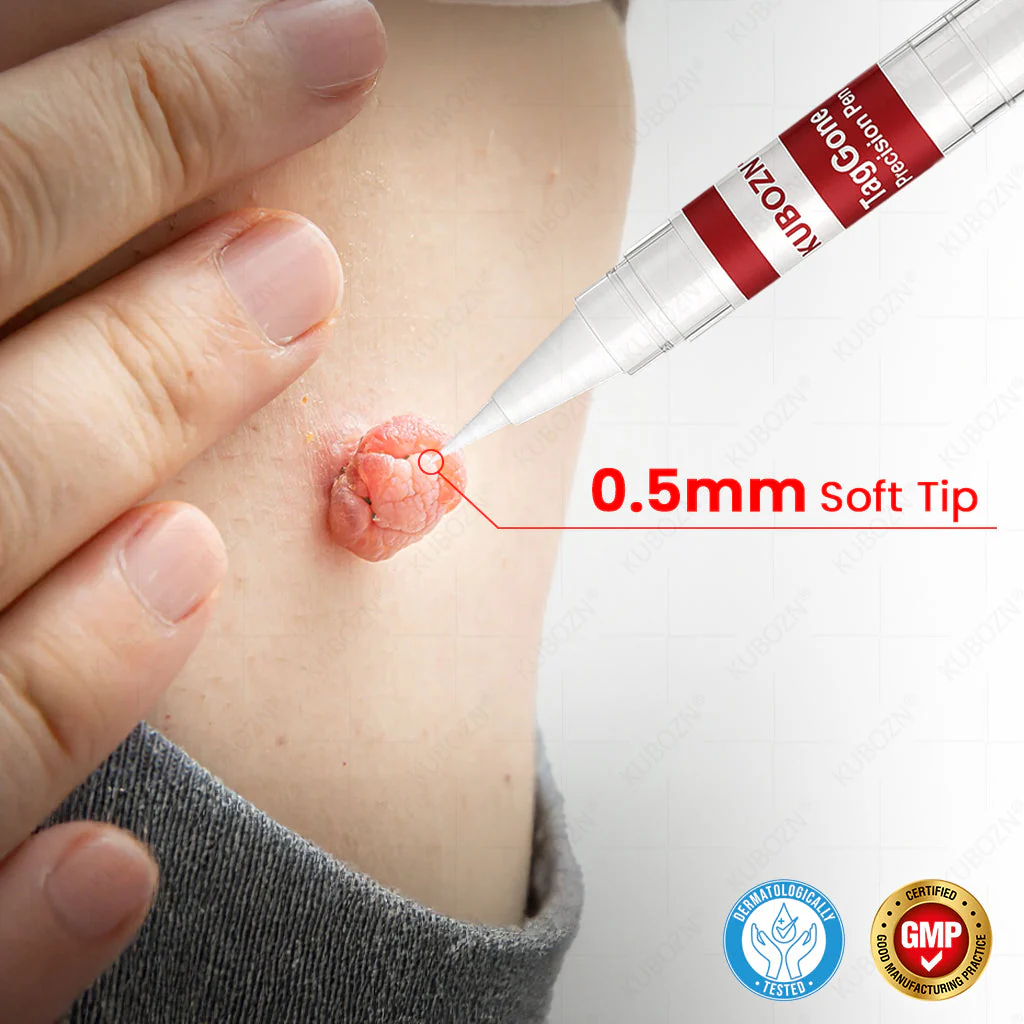 ✨KUBOZN® TagGone Precision Pen (2025 Upgrade) | Skin Tag, Mole & Wart Remover – Fast, Gentle & Scar-Free in 5 Days (offer) - Image 3