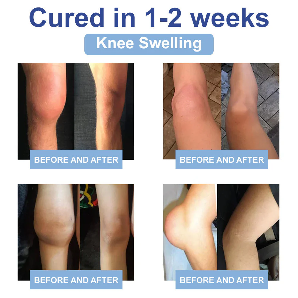 ✅Officially Recommended KUBOZN® Advanced Magnesium Pain Relief Cream (Treats Arthritis, Neuropathy, Rheumatism, Sports Injuries & More) - Image 6