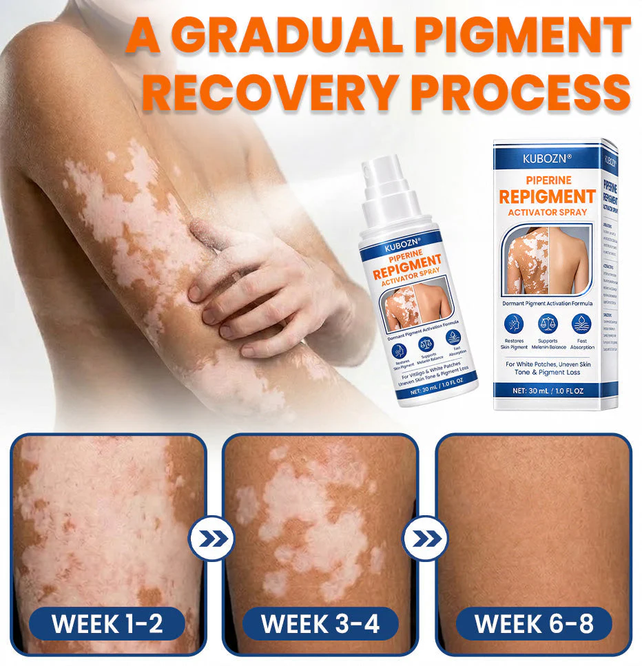 ⚡KUBOZN® Piperine Repigment Activator Spray to Reactivate Dormant Pigment Cells & Restore Natural Skin Color - Image 4