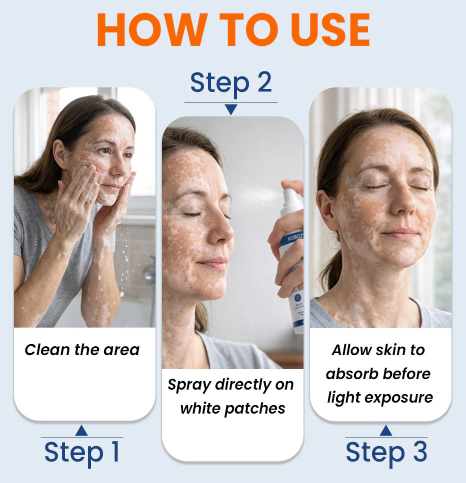⚡KUBOZN® Piperine Repigment Activator Spray to Reactivate Dormant Pigment Cells & Restore Natural Skin Color - Image 5