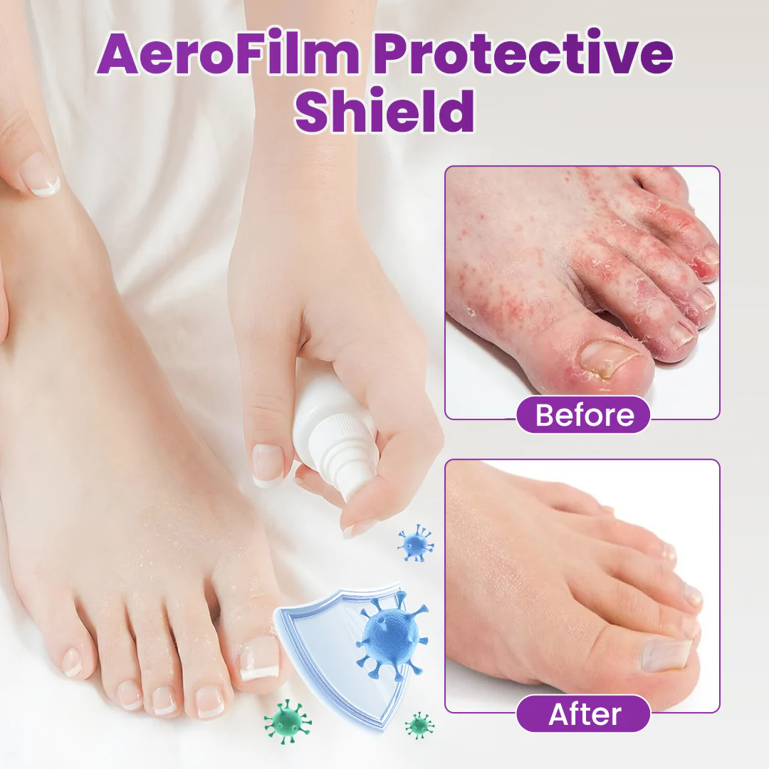 Cvreoz® AeroFilm Foot Defense Mist - Image 4