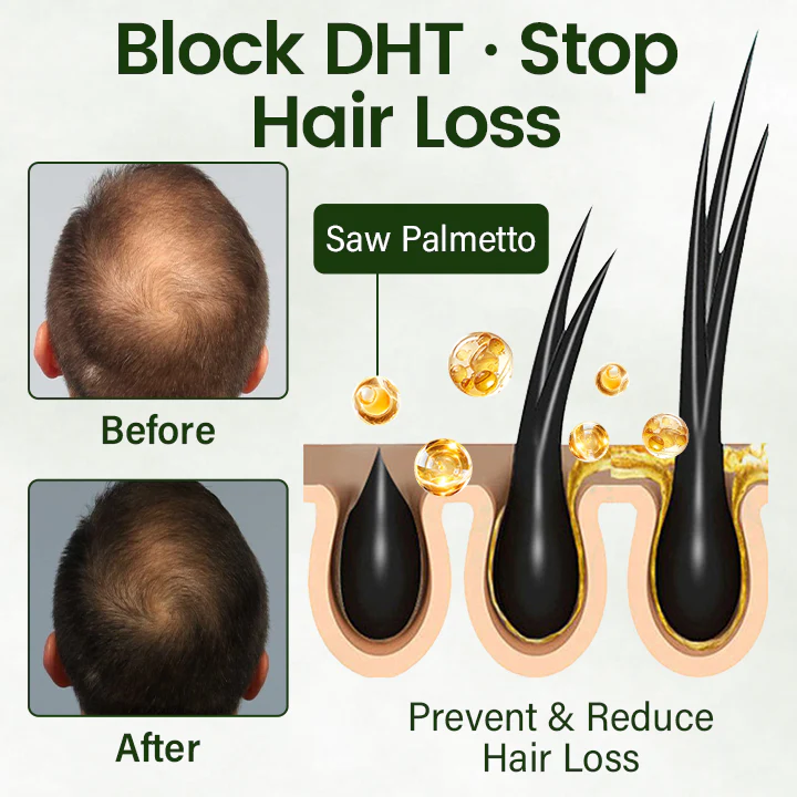 🅱︎Cvreoz® Follicure BioGrow Hair Restoration Spray ( Reawaken Your Roots. Regrow Naturally. ✨ Clinically Proven Hair Regrowth Within 4 Weeks ✨) - Image 3