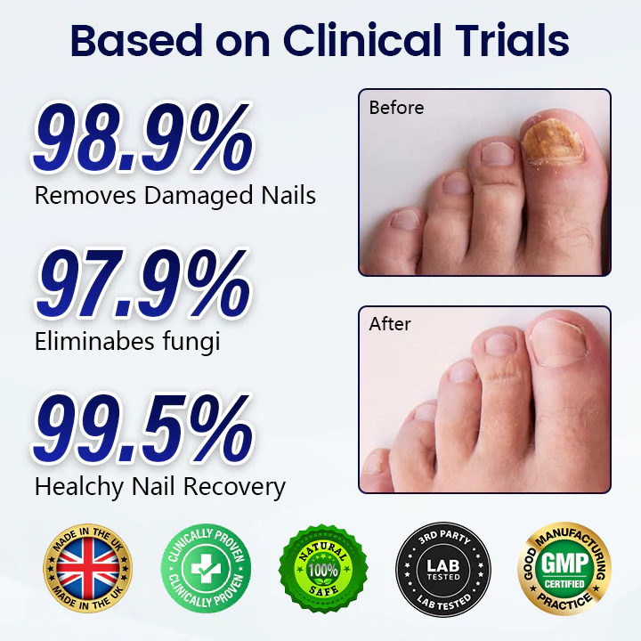 Healrize® Anti-Fungal Nail Repair Patch - Image 2