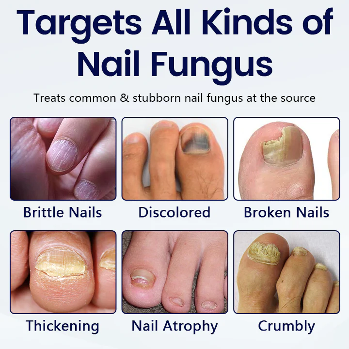 Healrize® Anti-Fungal Nail Repair Patch - Image 3