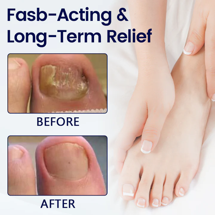 Healrize® Anti-Fungal Nail Repair Patch - Image 4