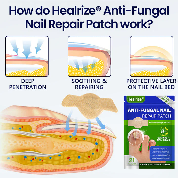 Healrize® Anti-Fungal Nail Repair Patch - Image 5