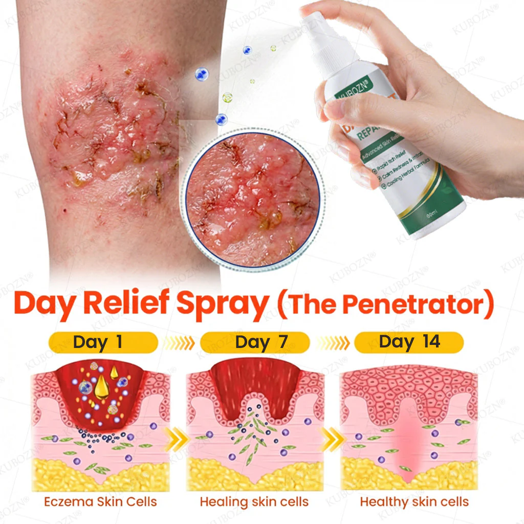 KUBOZN® Eczema Day & Night Repair System - 100% Steroid-Free Relief Duo for Intense Itch, Redness & Broken Skin - Image 2