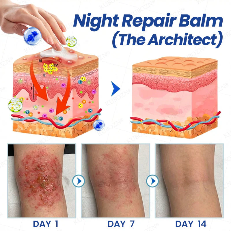 KUBOZN® Eczema Day & Night Repair System - 100% Steroid-Free Relief Duo for Intense Itch, Redness & Broken Skin - Image 3