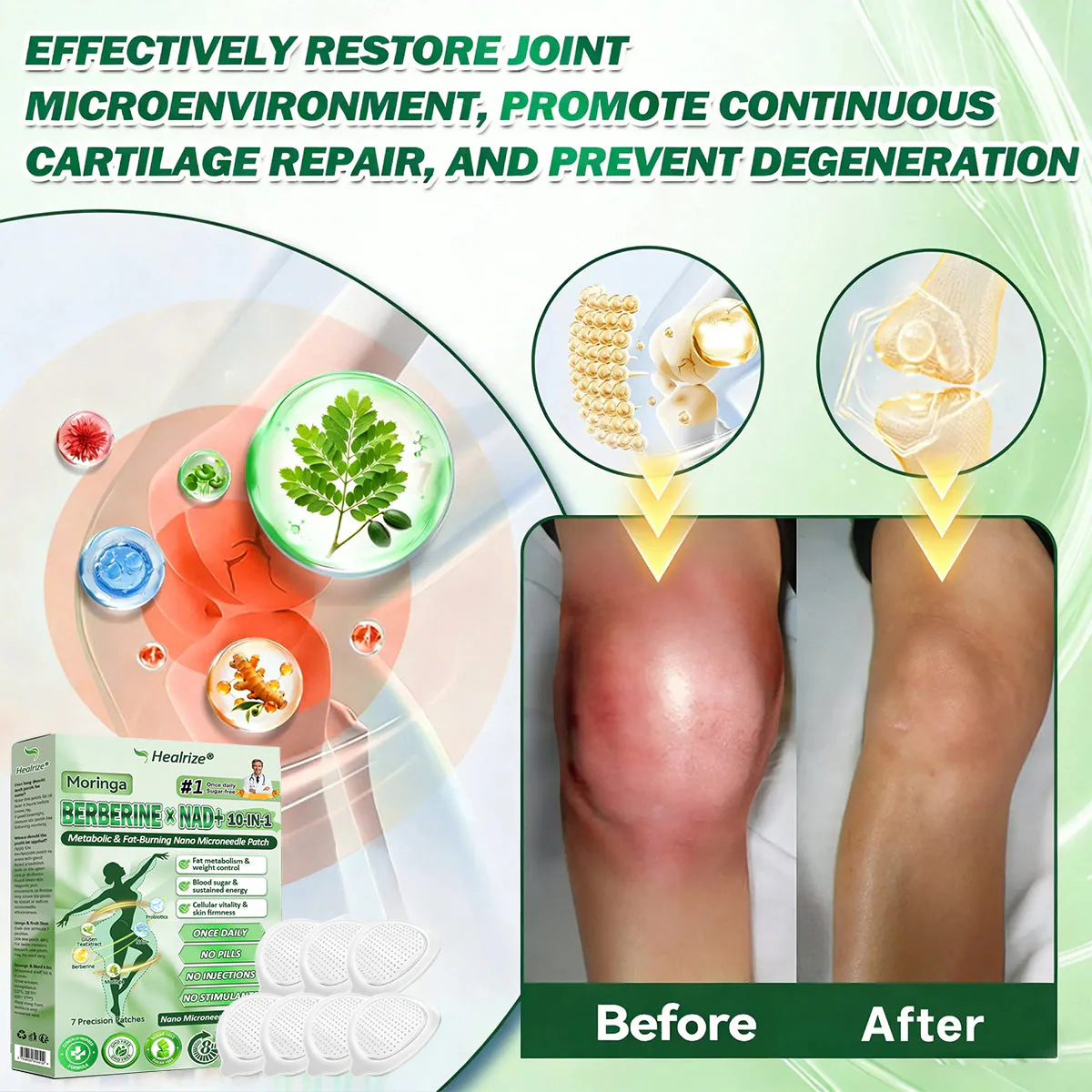 𝗢𝗳𝗳𝗶𝗰𝗶𝗮𝗹 𝗦𝘁𝗼𝗿𝗲 | ⏳⏳Healrize® 𝙈𝒐𝒓𝒊𝒏𝒈𝗮 · 𝗕𝗲𝗿𝗯𝐞𝐫𝐢𝐧𝙚 × 𝙉𝑨𝑫+ 𝟏𝟎-𝙞𝙣-1 𝘼𝒅𝒗𝒂𝒏𝒄𝒆𝐝 𝐍𝐚𝐧𝙤 𝙈𝙞𝙘𝙧𝙤𝙣𝒆𝒆𝒅𝒍𝐞 𝐏𝐚𝐭𝙘𝙝(𝗝𝘂𝘀𝘁 𝗼𝗻𝗰𝗲 𝗮 𝗱𝗮𝘆, 𝘃𝗶𝘀𝗶𝗯𝗹𝗲 𝗿𝗲𝘀𝘂𝗹𝘁𝘀 𝗶𝗻 𝟳 𝗱𝗮𝘆𝘀) ✅𝗙𝗼𝗿: 𝗼𝗯𝗲𝘀𝗶𝘁𝘆, 𝗹𝗼𝗼𝘀𝗲 𝘀𝗸𝗶𝗻, 𝘁𝘆𝗽𝗲 𝟮 𝗱𝗶𝗮𝗯𝗲𝘁𝗲𝘀, 𝘀𝗹𝗲𝗲𝗽 𝗮𝗽𝗻𝗲𝗮, 𝗷𝗼𝗶𝗻𝘁 𝗶𝘀𝘀𝘂𝗲𝘀, 𝗮𝗻𝗱 𝗺𝗼𝗿𝗲 - Image 7