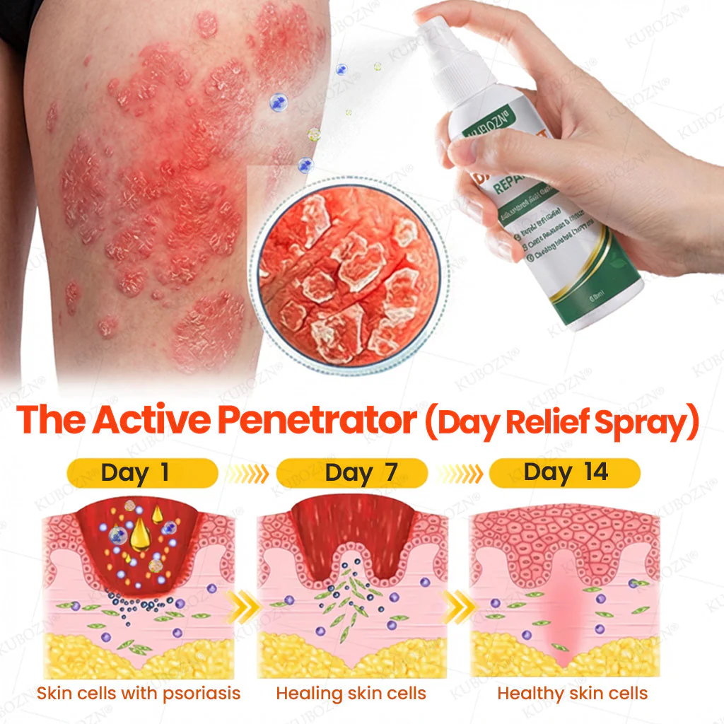 KUBOZN® Psoriasis Day & Night Repair System - 100% Steroid-Free Relief Duo for Plaques, Scaling & Itch - Image 2