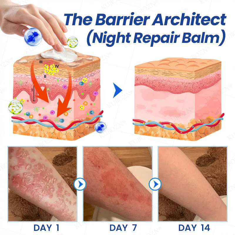 KUBOZN® Psoriasis Day & Night Repair System - 100% Steroid-Free Relief Duo for Plaques, Scaling & Itch - Image 3
