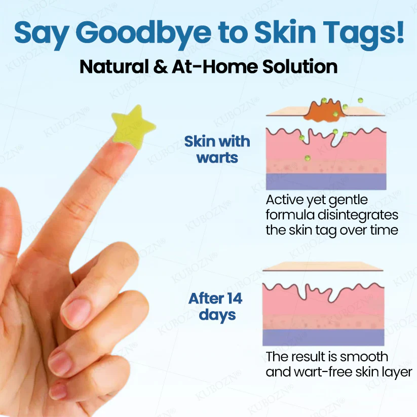 ✨KUBOZN® Pro MicroDarts Star Patch – Painless, Fast & Effective Skin Tag Removal 🅱︎ - Image 6