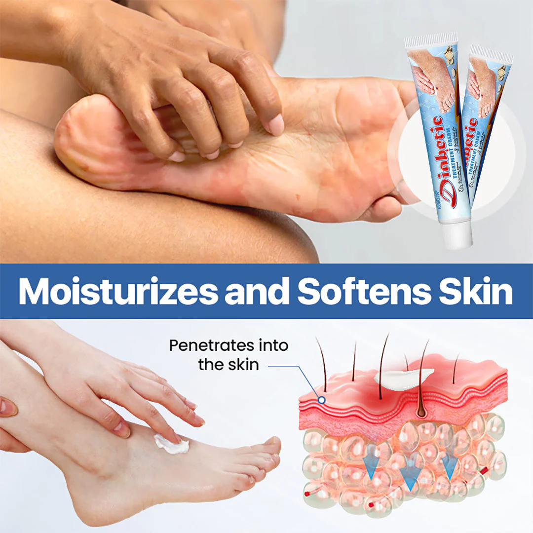 KUBOZN®VitaGluco Diabetes Treatment Cream -👨‍⚕️Dermatologist-Recommended Formula - Image 6