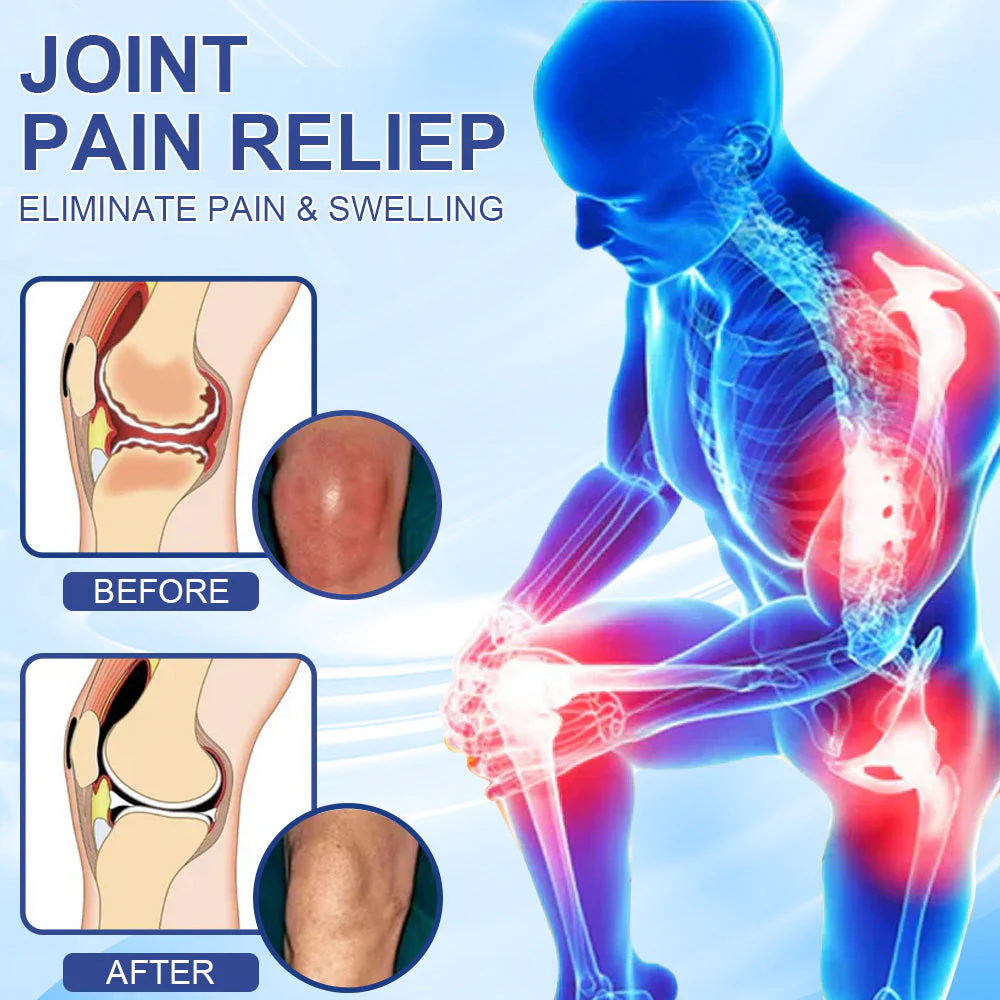KUBOZN® Advanced Magnesium Absorption Cream for Arthritis, Neuropathy & Joint Pain (offer) - Image 4