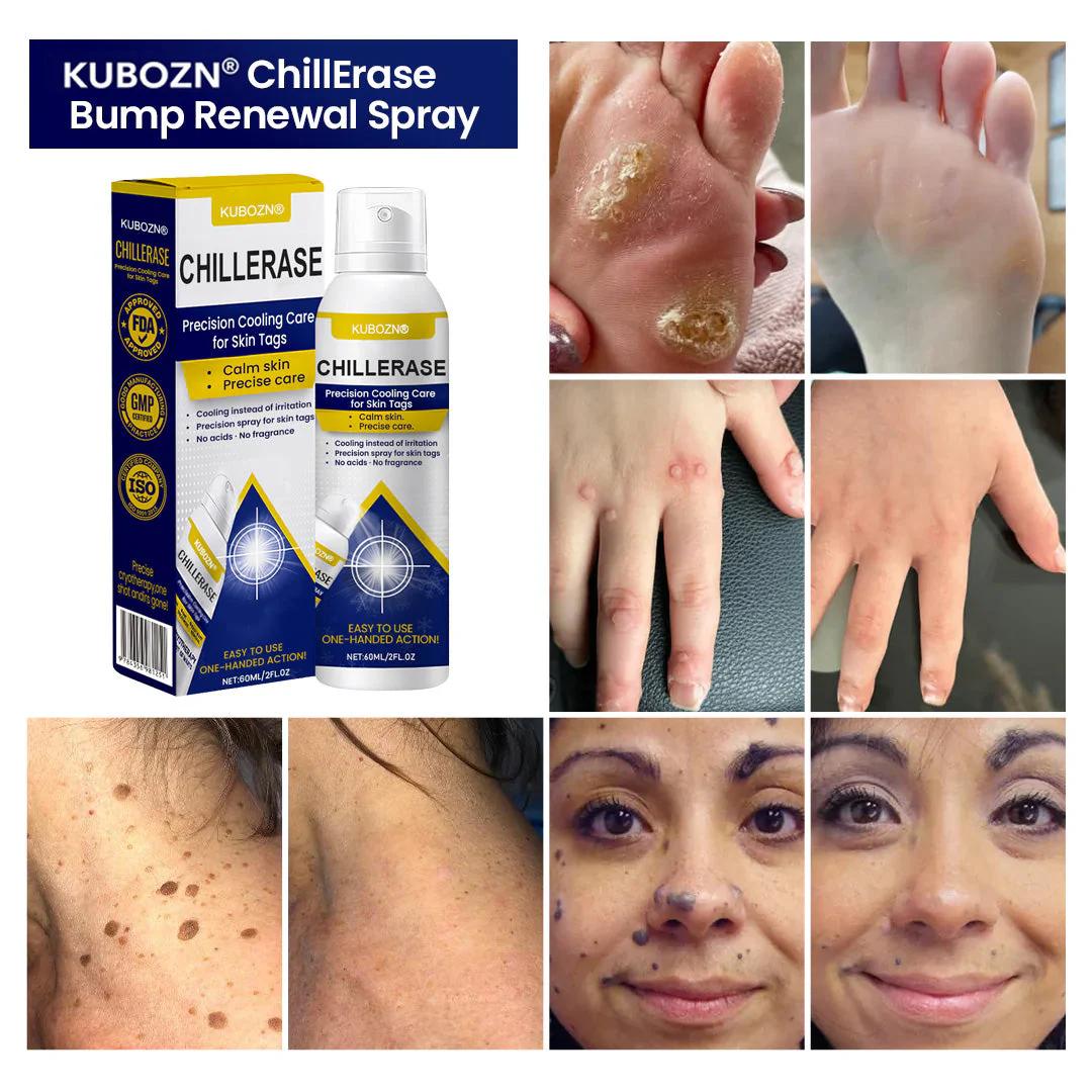 KUBOZN® ChillErase Cooling Spray for Skin Tags - Image 2