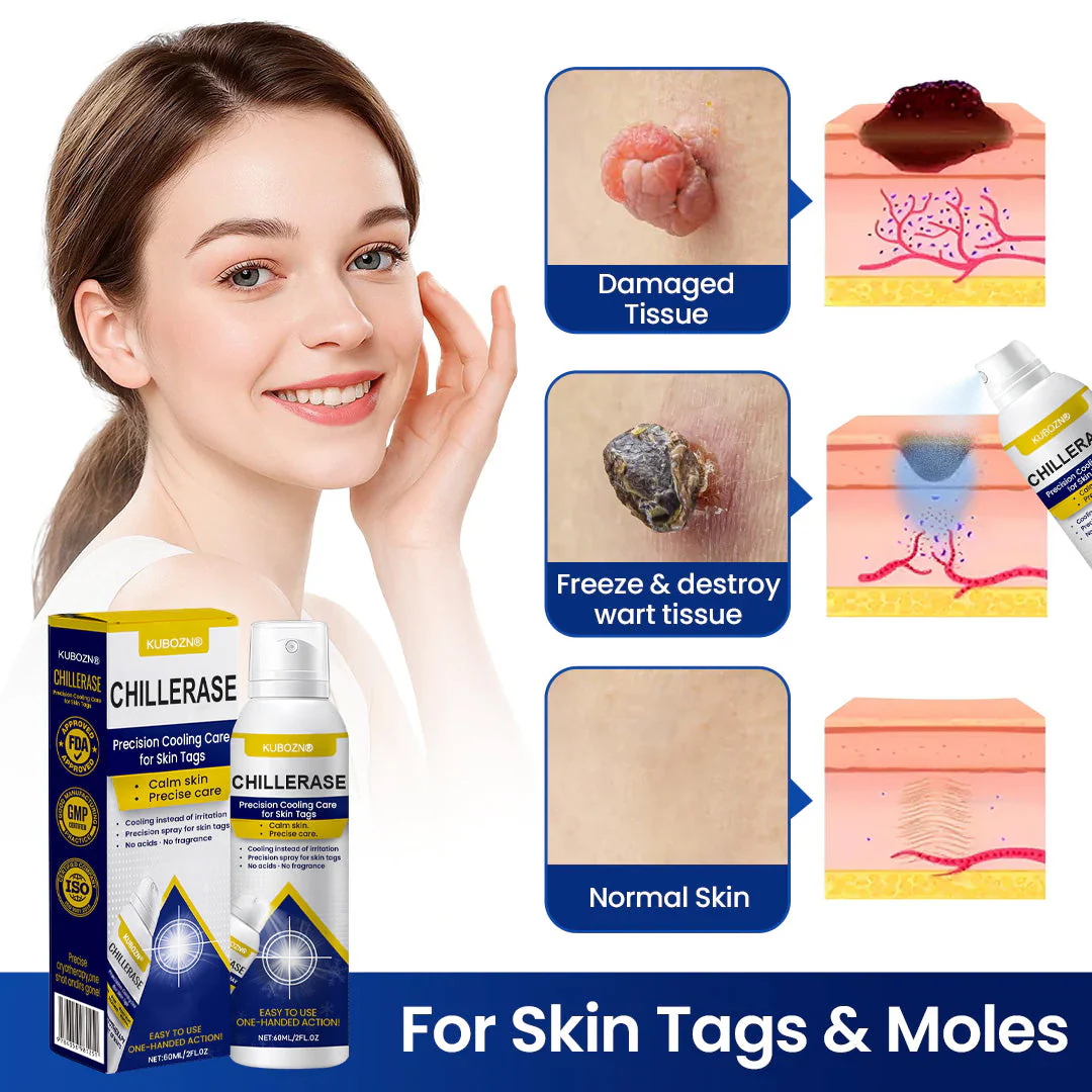 KUBOZN® ChillErase Cooling Spray for Skin Tags - Image 7