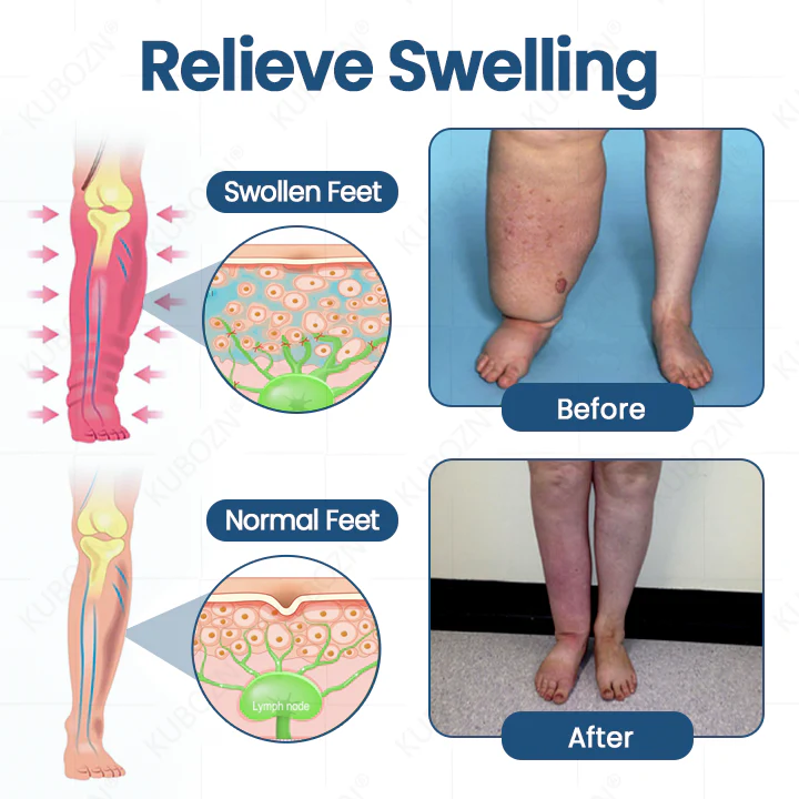 ✨KUBOZN® Roll-On Cream for Lymphatic Drainage & Swelling Relief  🅱︎ - Image 5