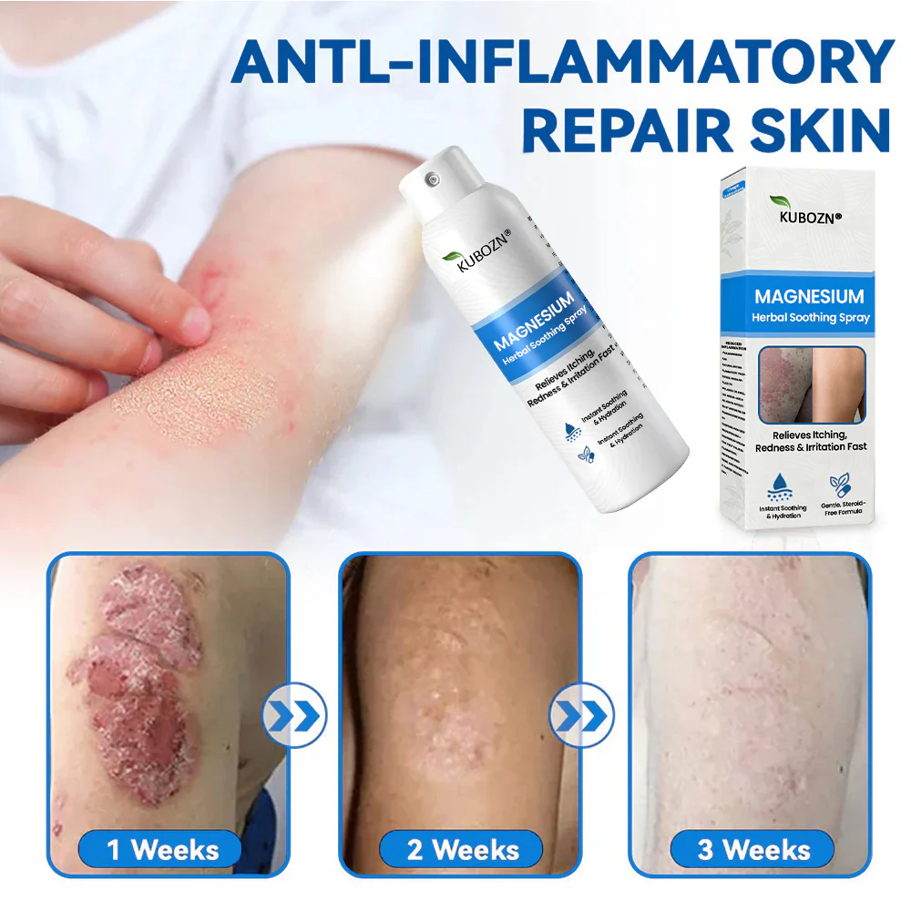 ✅ Official Store: KUBOZN® Magnesium Herbal Psoriasis Spray 👨‍⚕️ MHRA Approved (Relieves psoriasis and eczema, improves bacterial infections in the genital area, treats acne and warts) - Image 7