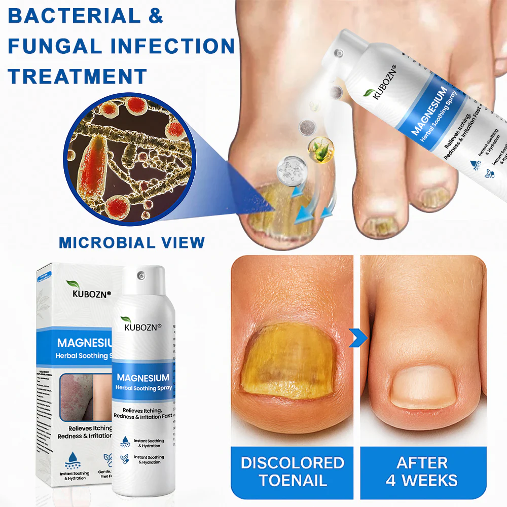 ✅ Official Store: KUBOZN® Magnesium Herbal Psoriasis Spray 👨‍⚕️ MHRA Approved (Relieves psoriasis and eczema, improves bacterial infections in the genital area, treats acne and warts) - Image 9