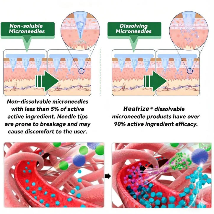 THE RETA-MICRO Triple G AGONIST Microneedle System - Image 5