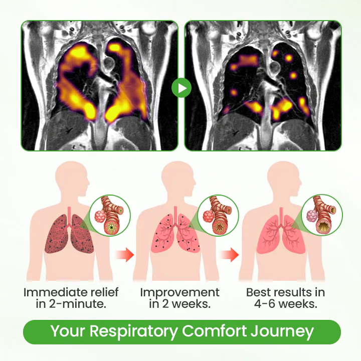 T Healrize® HerbaAir Mullein Lung Purifier - Image 7