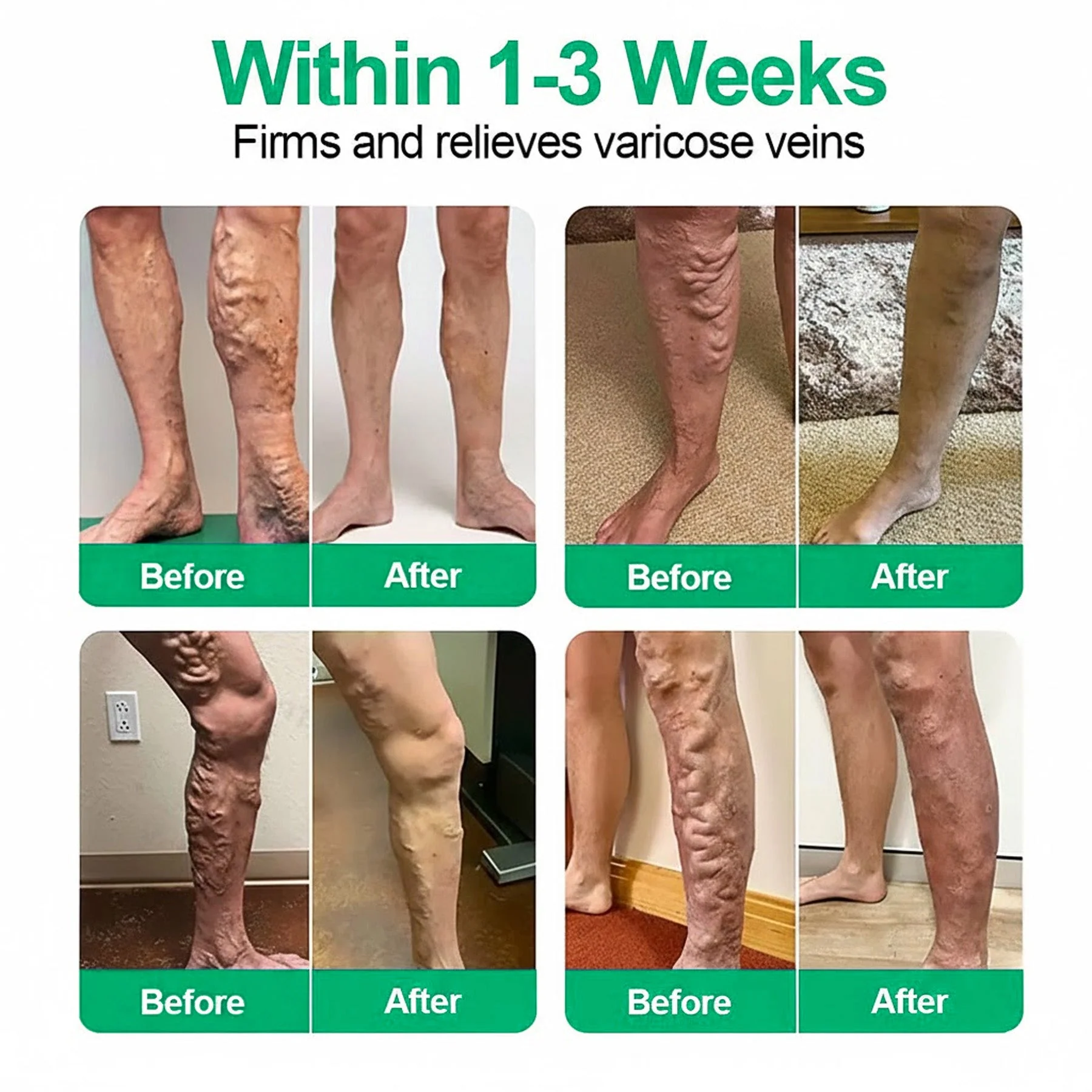 👨‍⚕️🔥Healrize® VeinEase Microneedle Care Patch⚡Instant Relief, Long-Term Results - Image 3