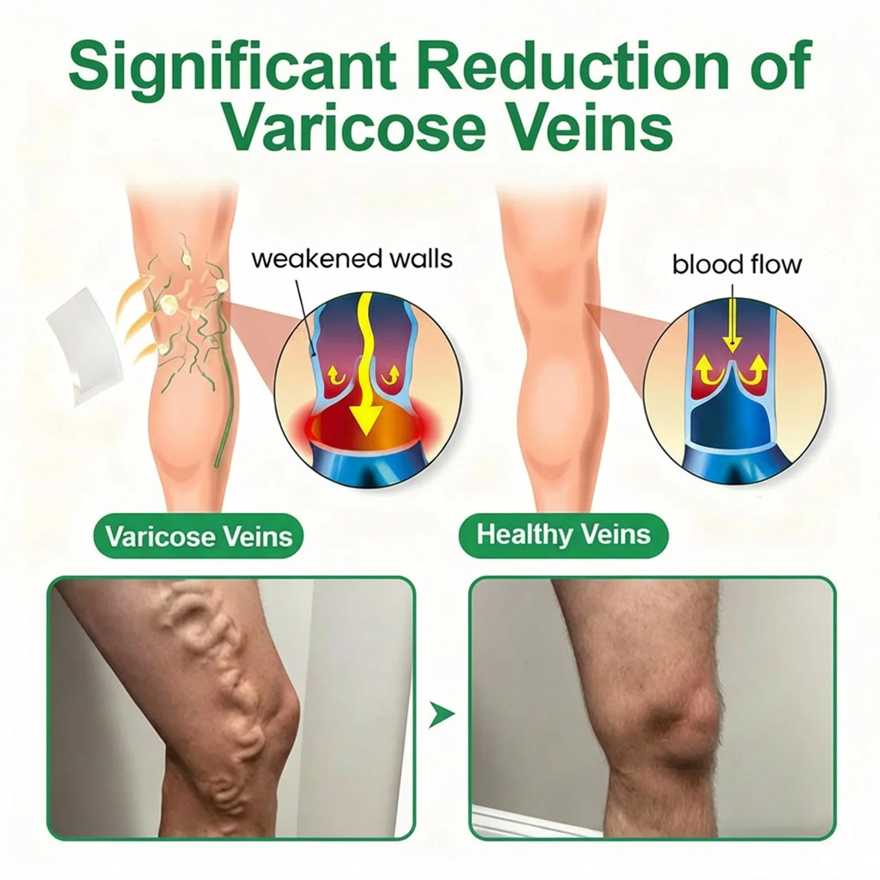 👨‍⚕️🔥Healrize® VeinEase Microneedle Care Patch⚡Instant Relief, Long-Term Results - Image 4